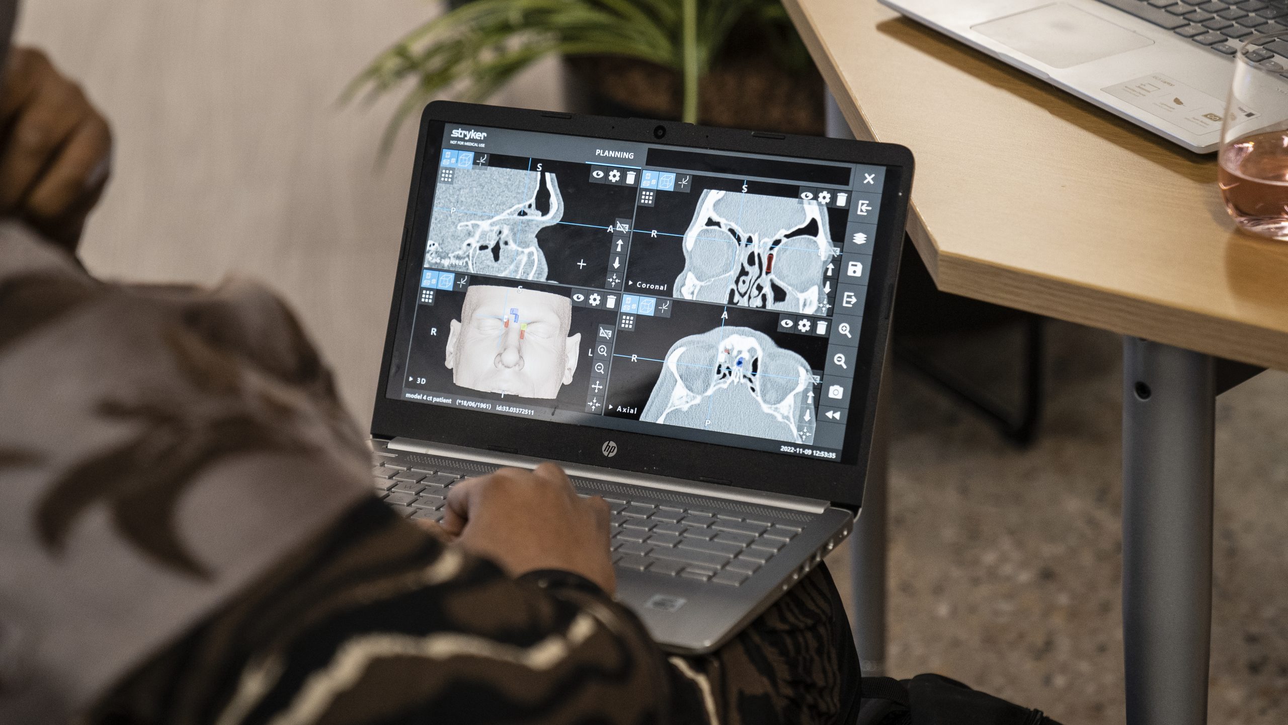 CT-guided surgical planning